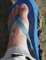 Mud on the flipflop.